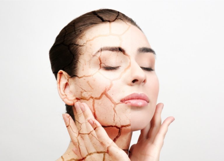 خشکی پوست صورت