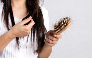 ریزش مو ناشی از سندرم تخمدان