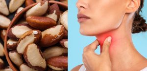 آجیل مناسب برای کم کاری تیروئید