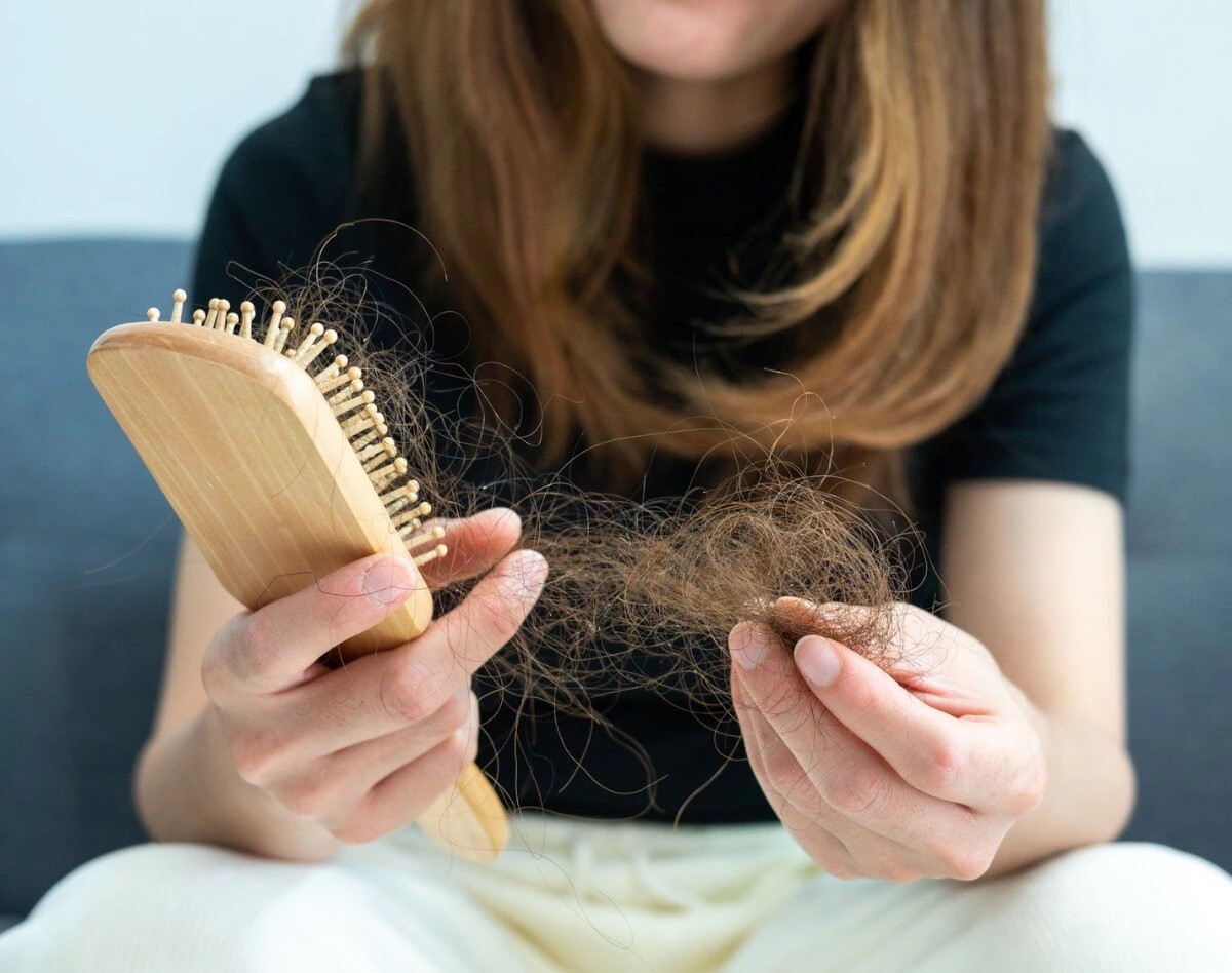 ریزش مو - ویتامین برای ریزش مو