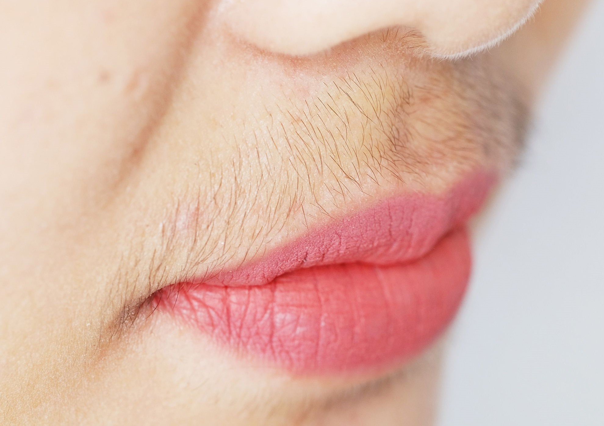 پرمویی پشت لب - پرمویی زنان