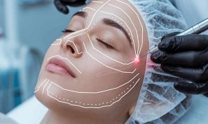 اندولیفت صورت