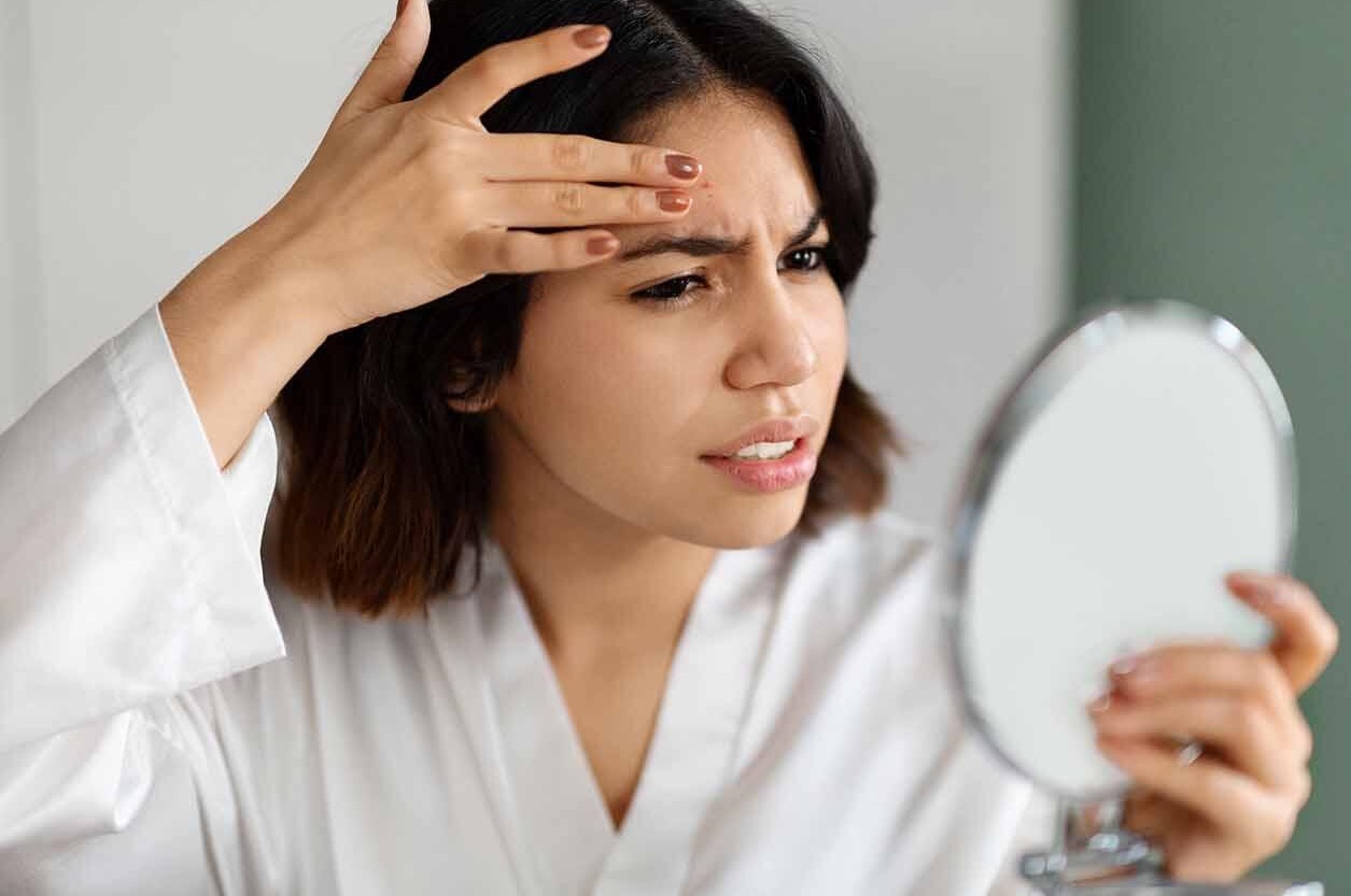 مشکلات پوستی - تاثیر استرس بر پوست