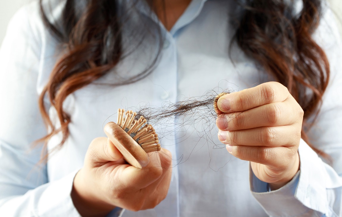 ریزش موی هورمونی - علت ریزش مو در حمام