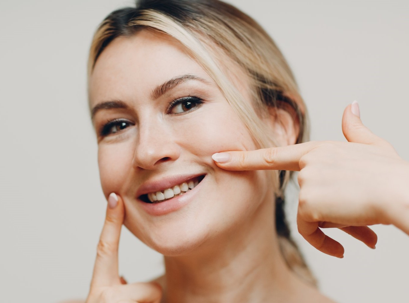 خط خنده - از بین بردن خط خنده