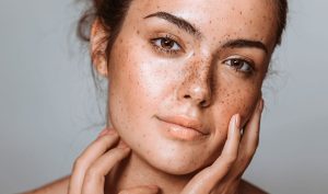 سریع ترین راه از بین بردن لک قهوه ای صورت