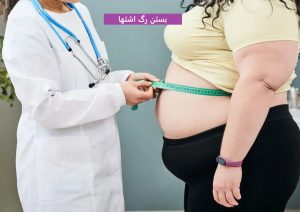 بستن رگ اشتها