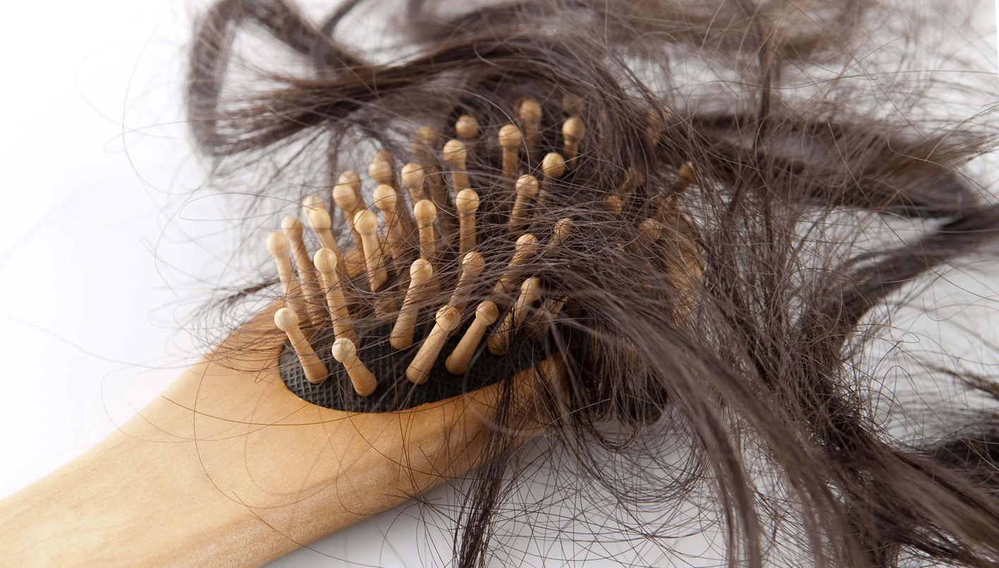 ریزش مو - درمان ریزش مو در بارداری