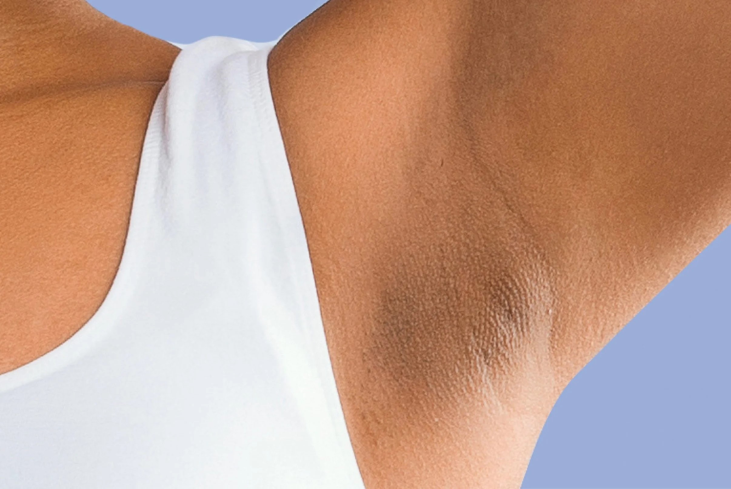 درمان تیرگی زیر بغل - رفع تیرگی زیر بغل