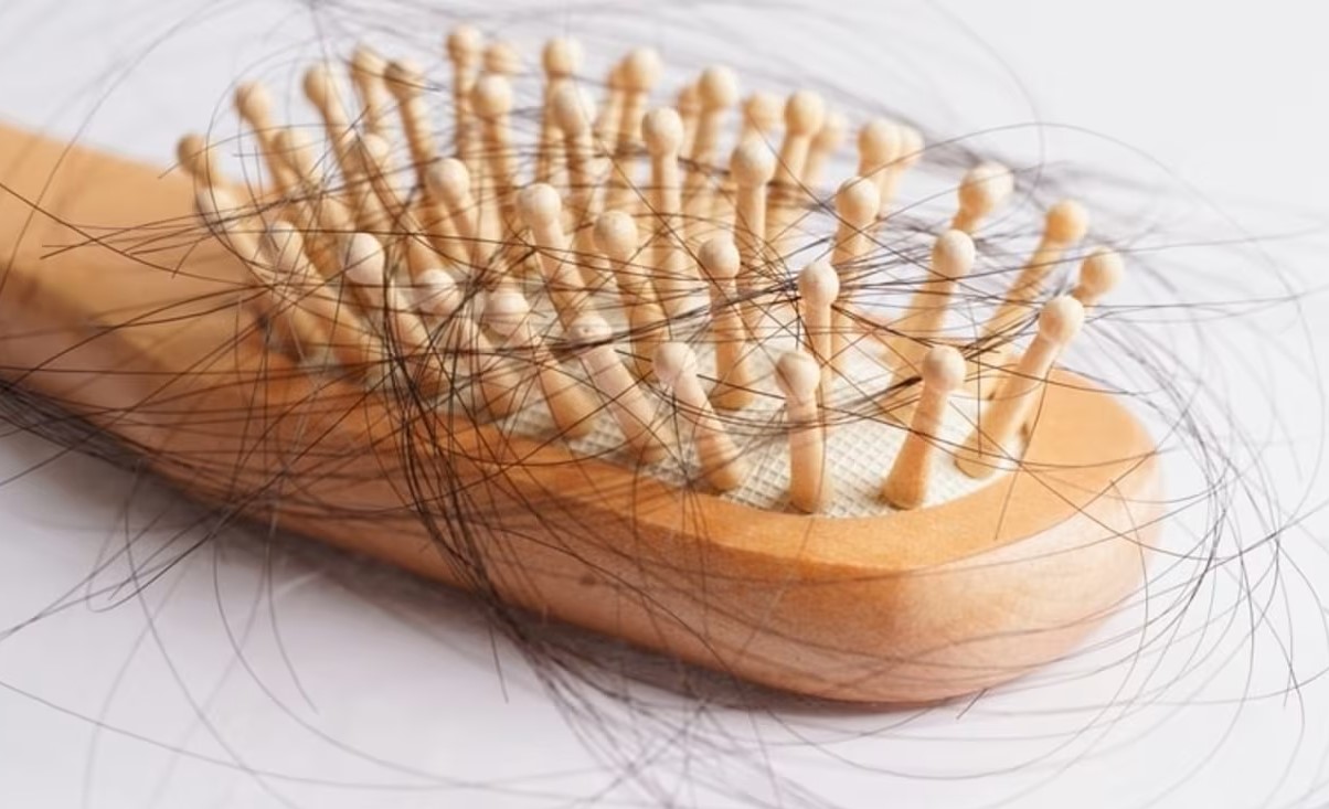 درمان ریزش مو - درمان ریزش مو در بارداری