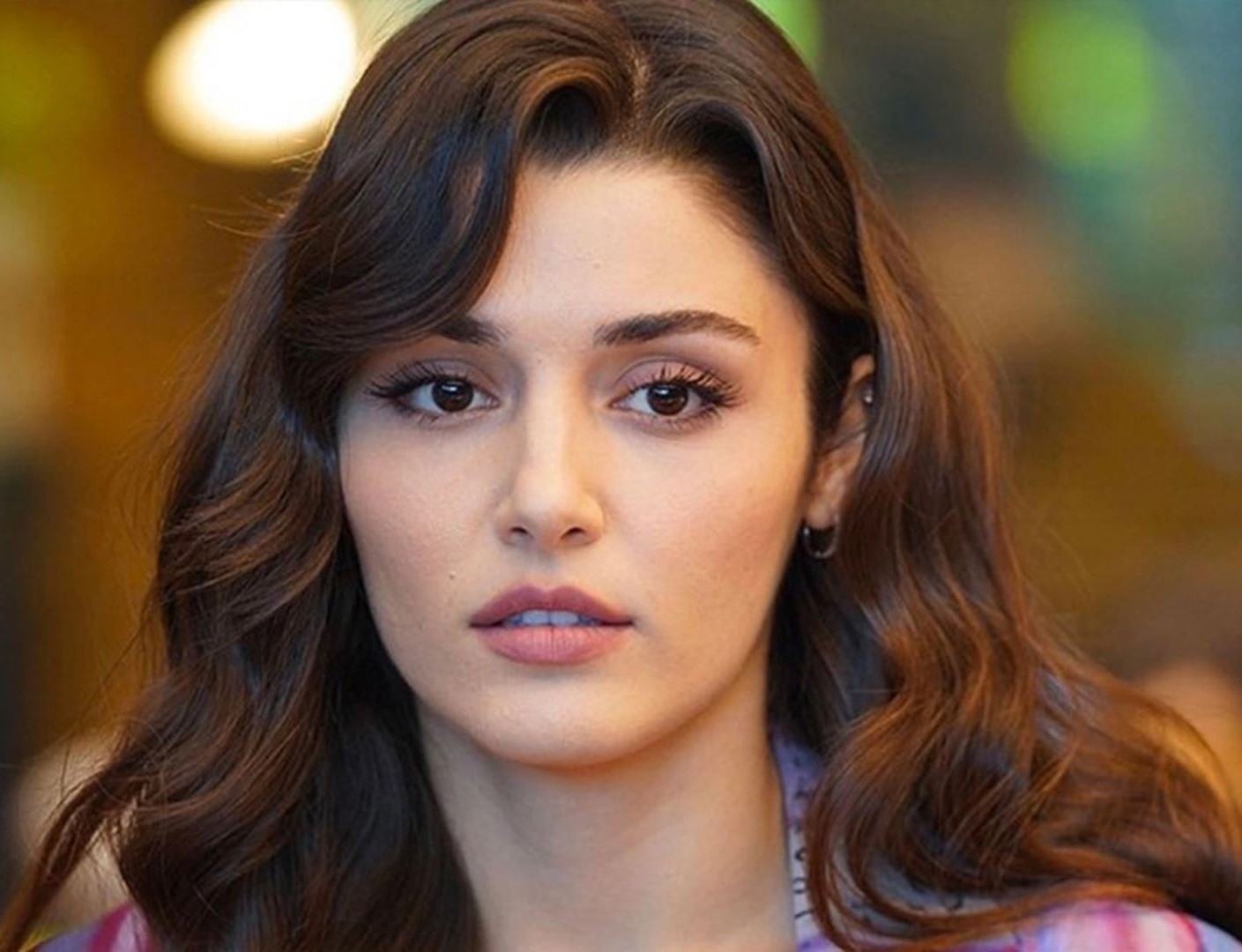 تزریق فیلر هانده ارچل - عمل های زیبایی هانده ارچل