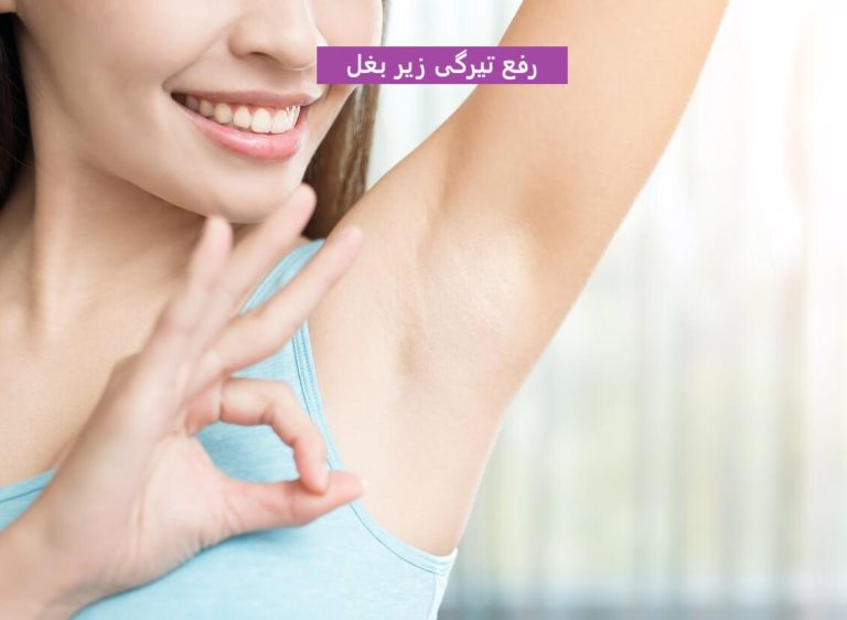 رفع تیرگی زیر بغل