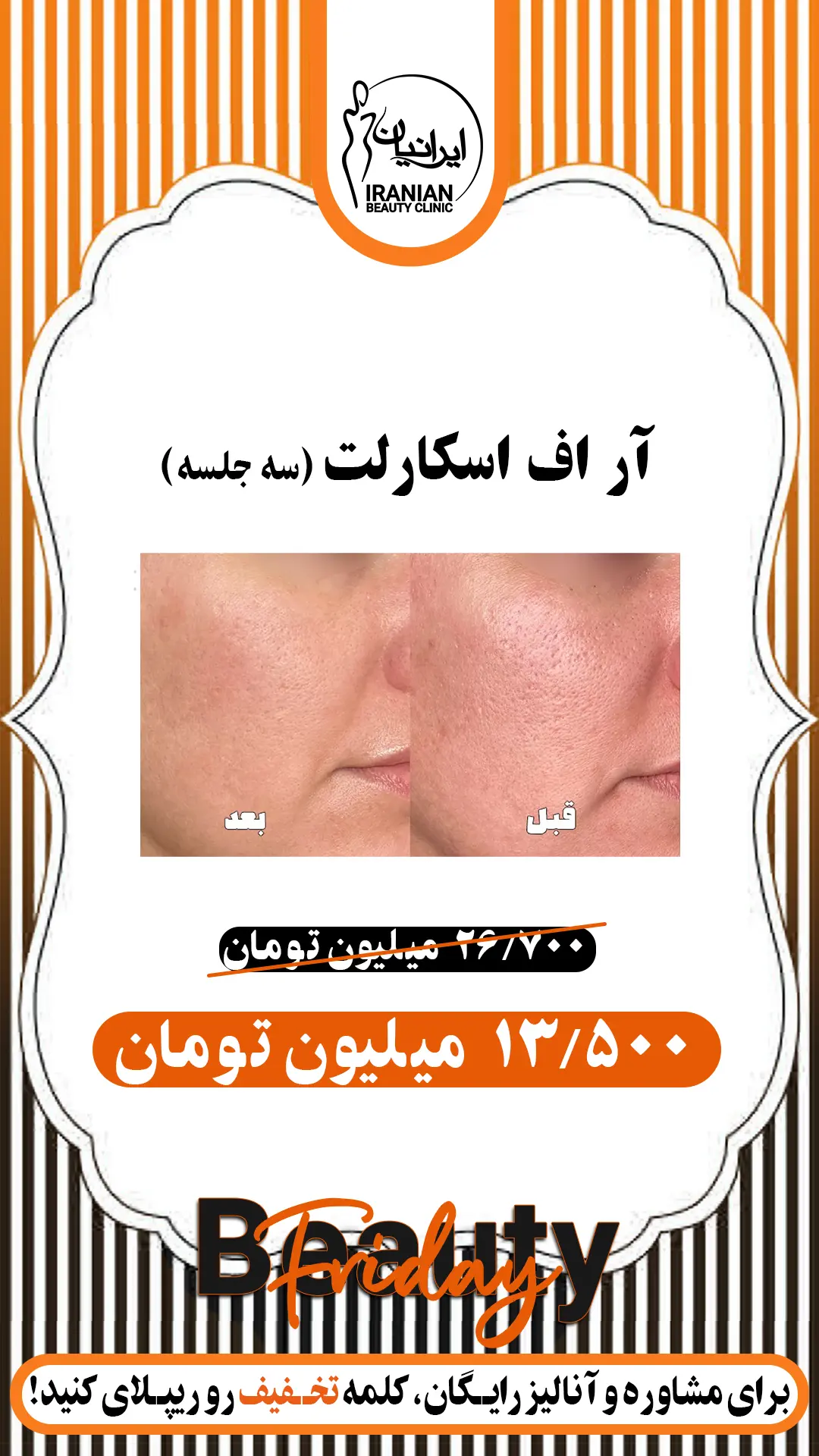 آر اف اسکارلت