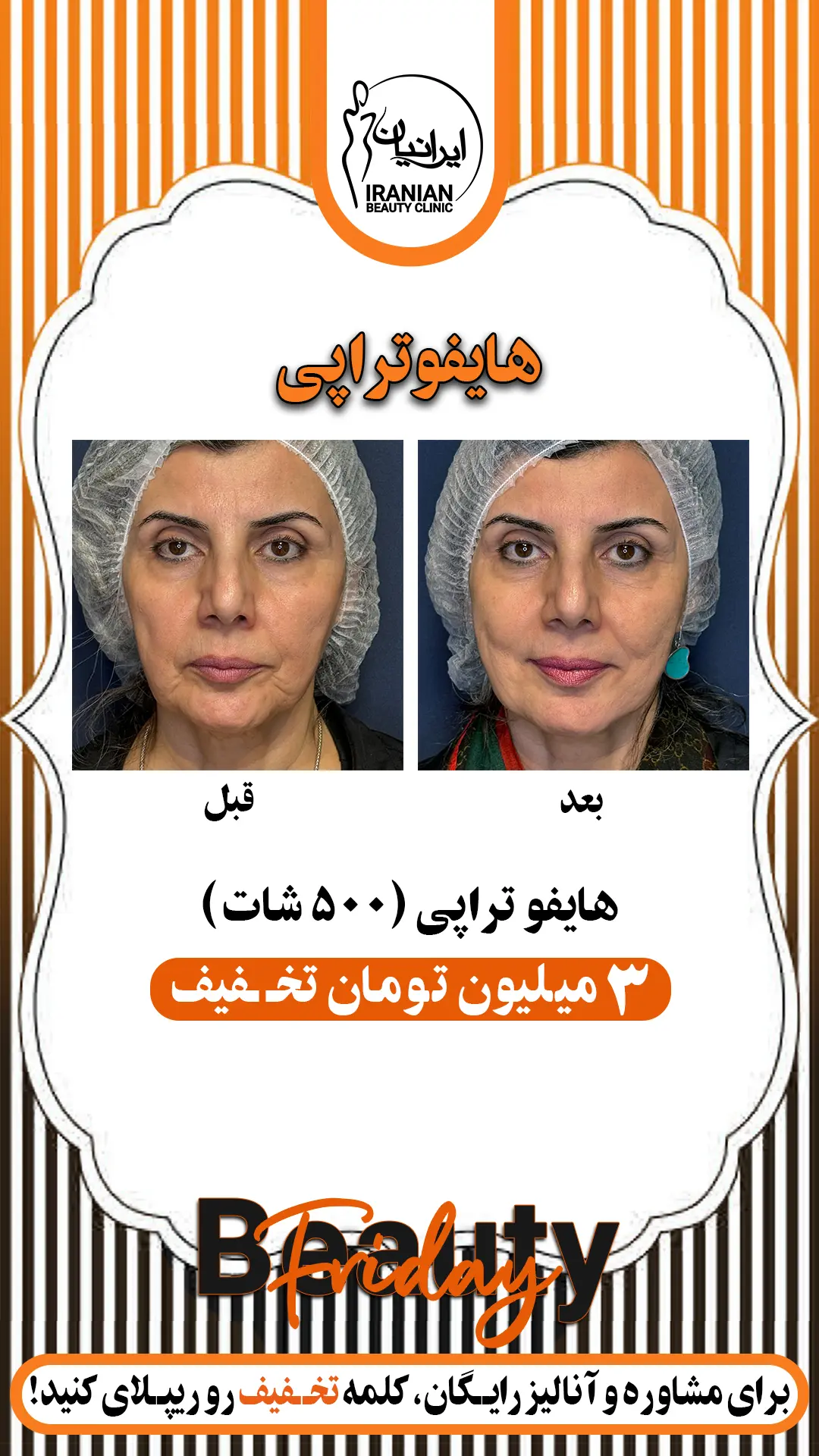 هایفوتراپی