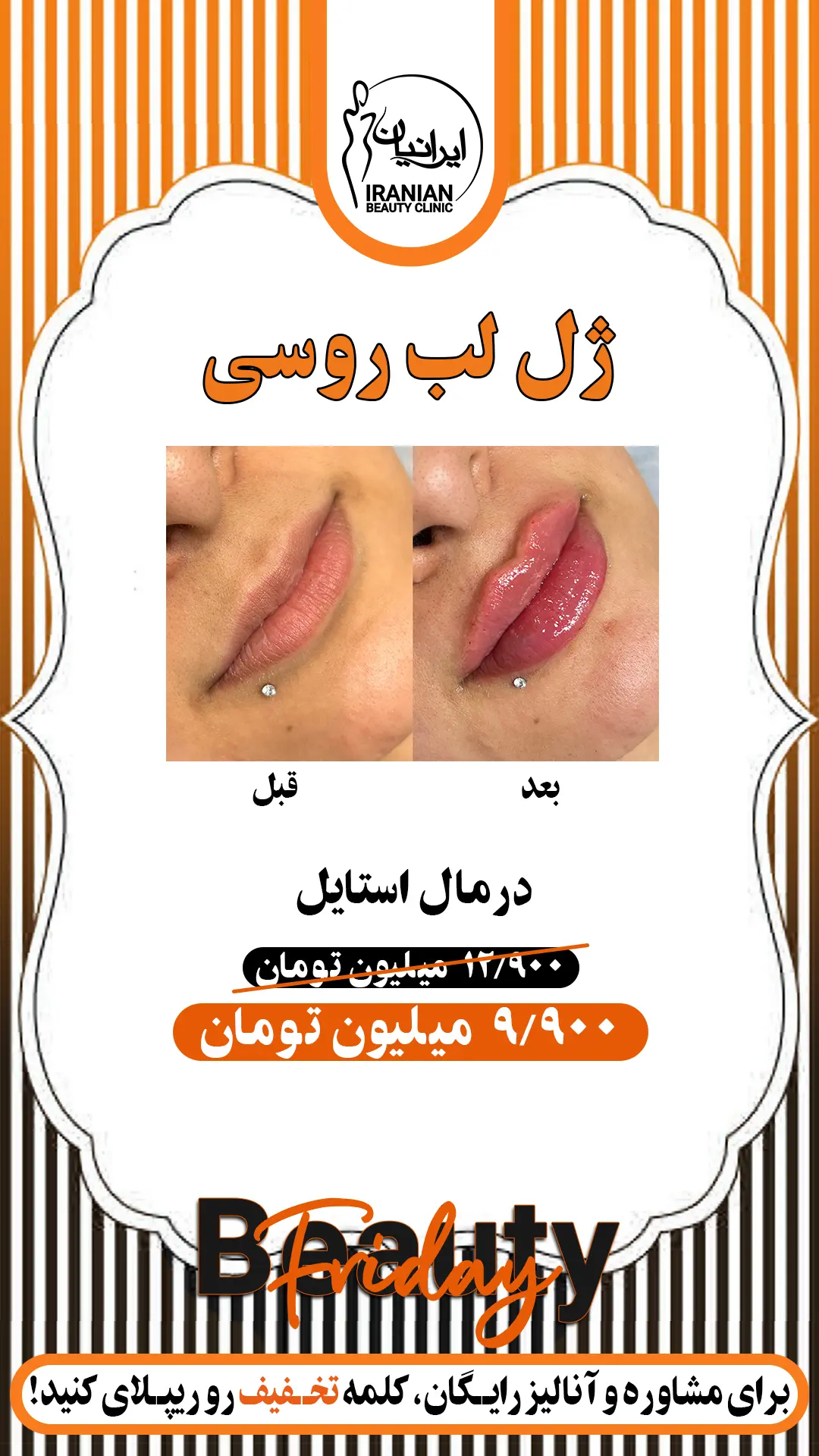 ژل لب درمال استایل