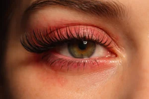 عوارض کاشت مژه